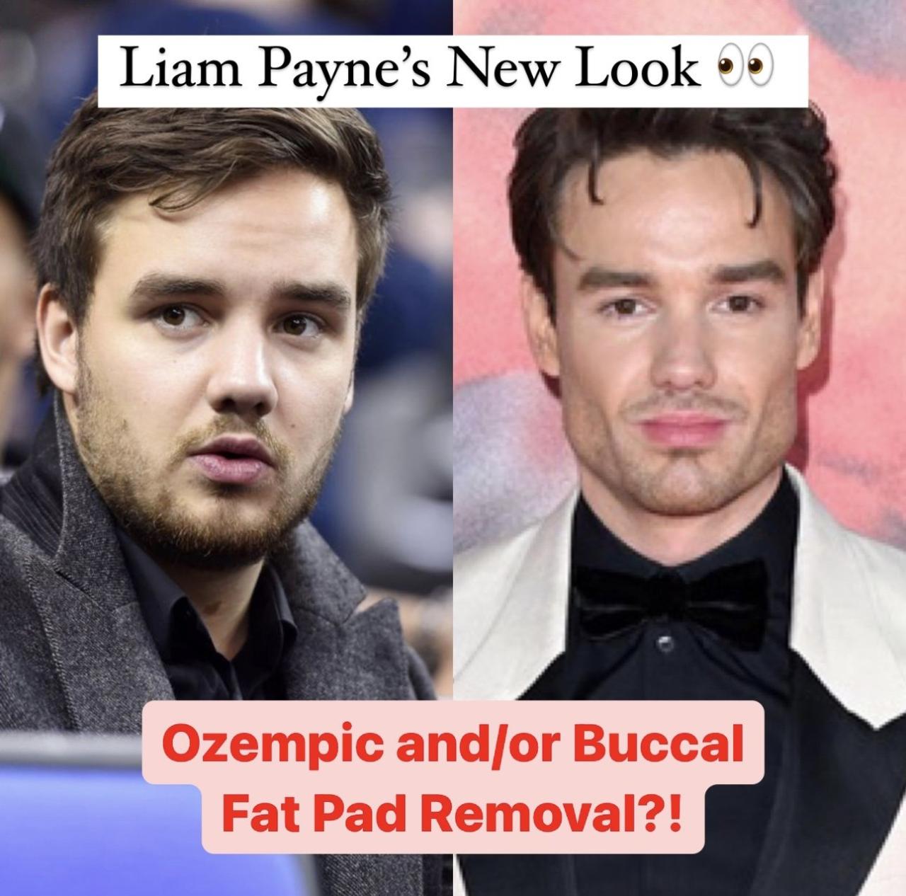 CHUTOGEL transformasi fisik Liam Payne